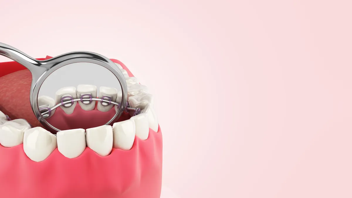 A patient considering lingual braces options