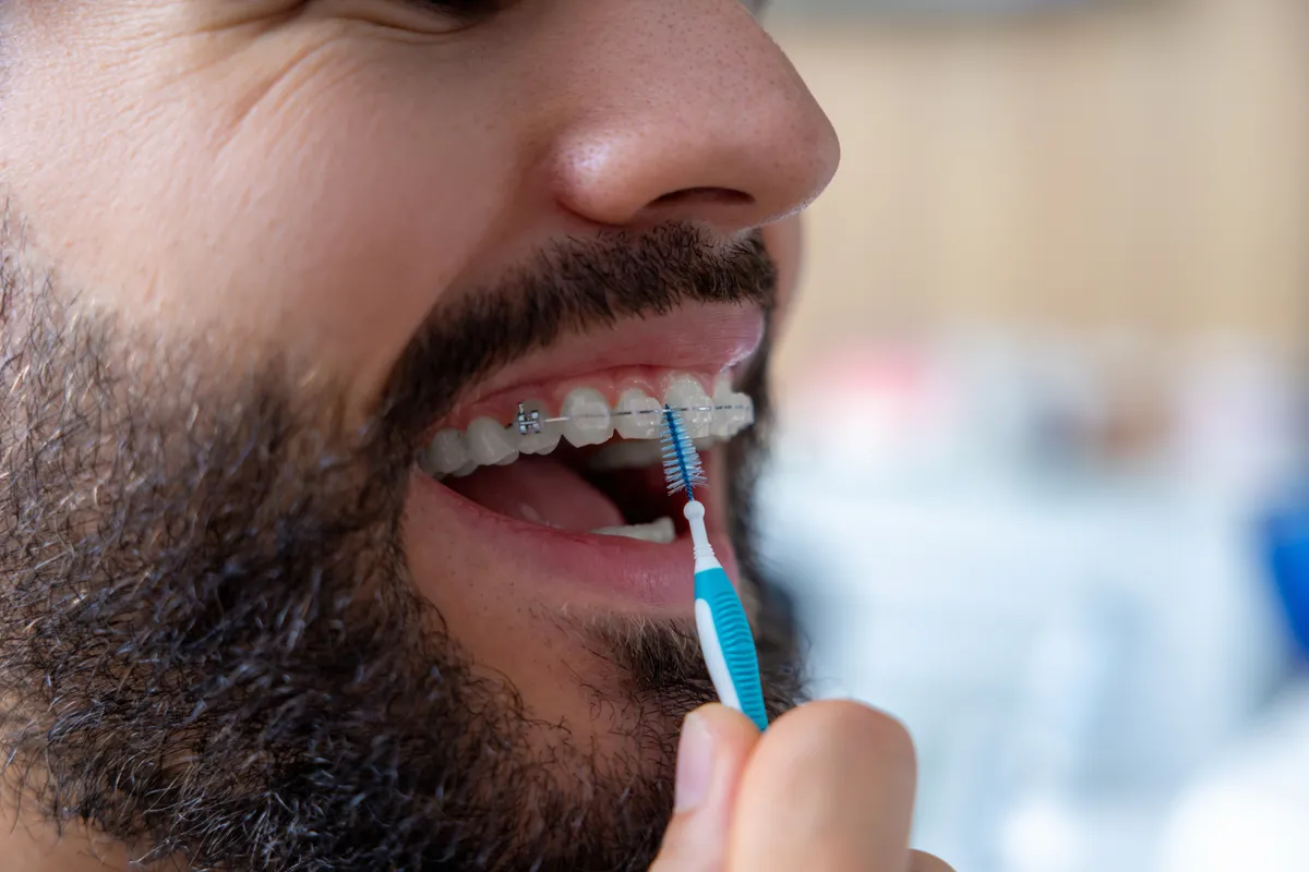 A patient checking their smile after braces removal