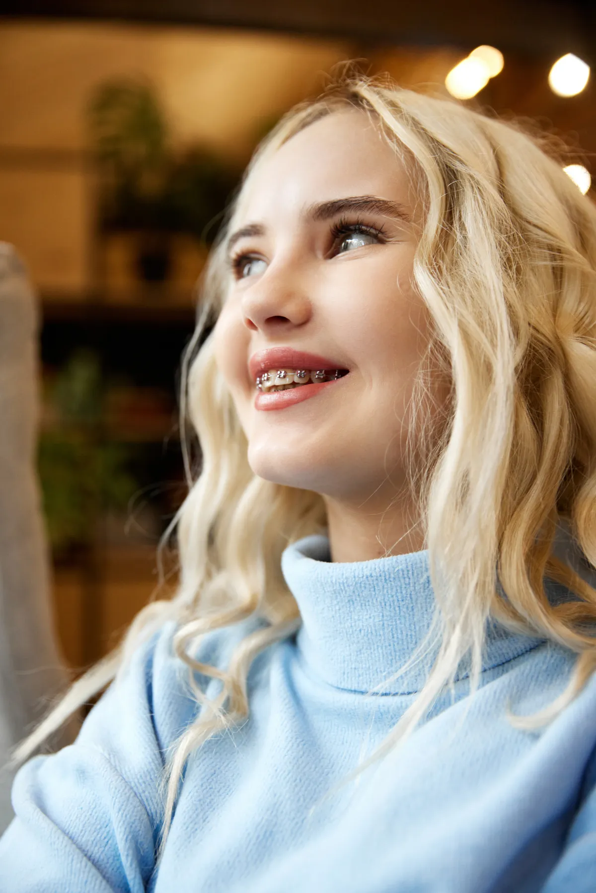 Metal Braces